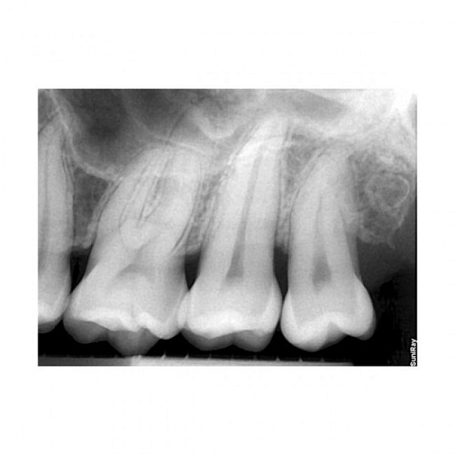 Suni SuniRay2 - система компьютерной радиовизиографии